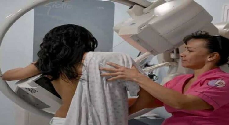 Realizará SSM mastografías gratuitas en 8 municipios